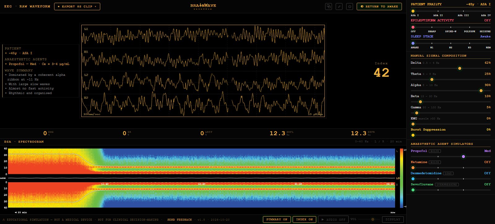 The Brainwave Neurosim monitor at moderate-dose propofol: four channels of slow waves with superimposed alpha, the summary panel and the depth index beside the trace, the parameter row, and the density spectral array running from a broadband red awake stretch through induction into a narrow alpha and delta band. The control panel on the right shows patient frailty, epileptiform, sleep-stage and artifact sliders, the manual band sliders, and four anaesthetic agents with propofol at Med.
